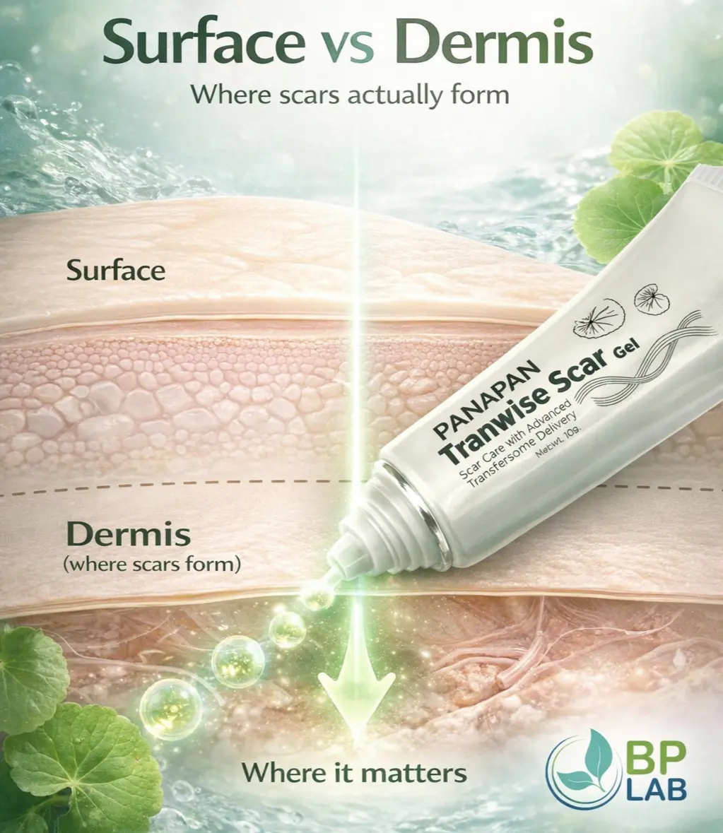 Surface vs Dermis skin layers